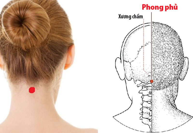 Vị trí huyệt Phong Phủ trên cơ thể 