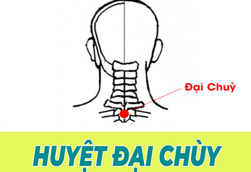 Huyệt Đại Chùy giúp cải thiện đau vai gáy